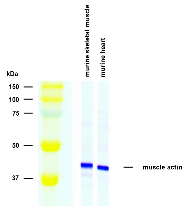 Actin (muscle) Antibody in Western Blot (WB)