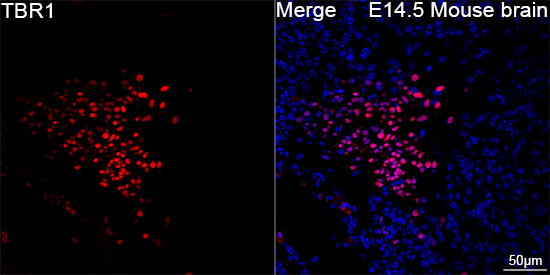 TBR1 Antibody in Immunohistochemistry (Paraffin) (IHC (P))