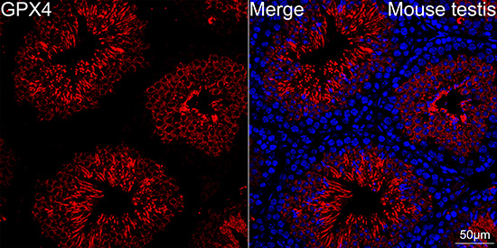 GPX4 Antibody in Immunohistochemistry (Paraffin) (IHC (P))