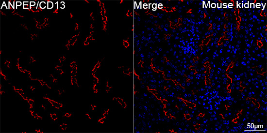 CD13 Antibody in Immunohistochemistry (Paraffin) (IHC (P))
