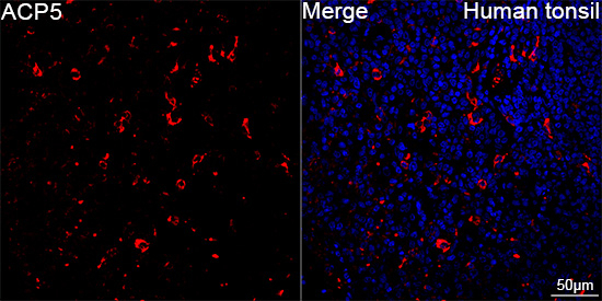 Tartrate Resistant Acid Phosphatase Antibody in Immunohistochemistry (Paraffin) (IHC (P))