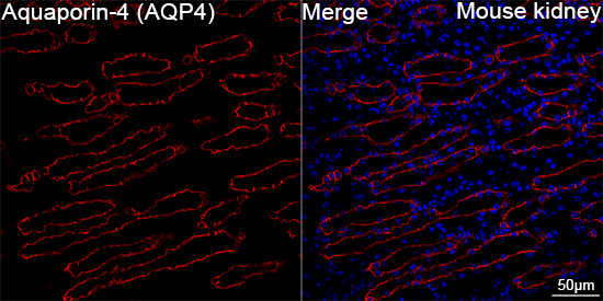 Aquaporin 4 Antibody in Immunohistochemistry (Paraffin) (IHC (P))