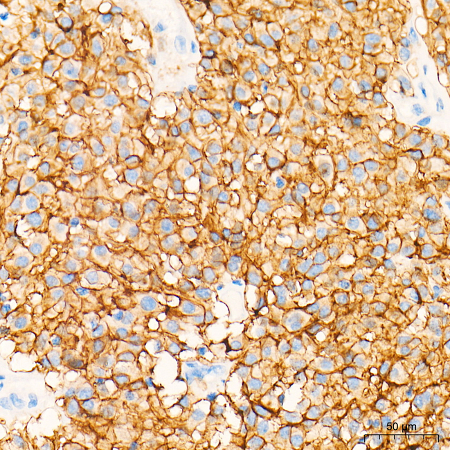 DOG-1 Antibody in Immunohistochemistry (Paraffin) (IHC (P))
