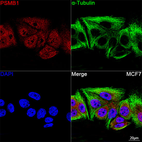 PSMB1 Antibody in Immunocytochemistry (ICC/IF)