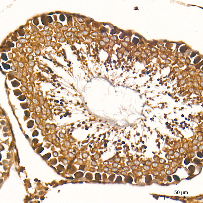 ZNF9 Antibody in Immunohistochemistry (Paraffin) (IHC (P))