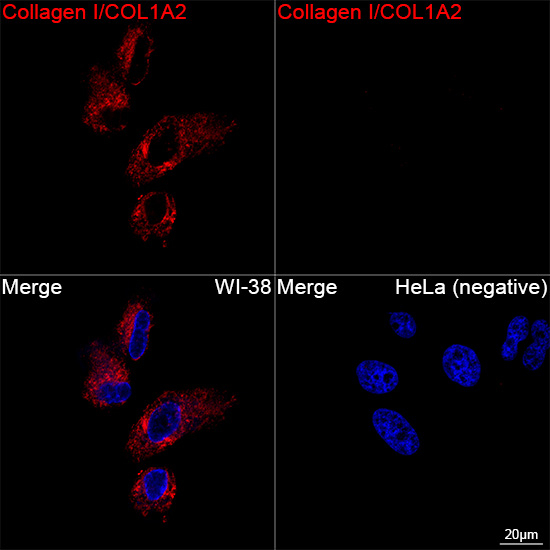 COL1A2 Antibody in Immunocytochemistry (ICC/IF)