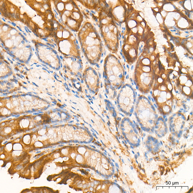 EXT1 Antibody in Immunohistochemistry (Paraffin) (IHC (P))