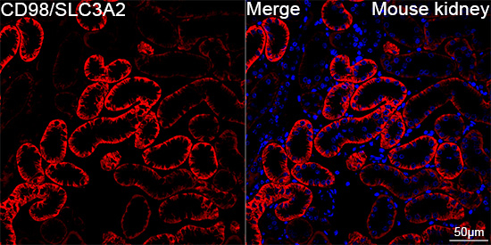 CD98 Antibody in Immunohistochemistry (Paraffin) (IHC (P))