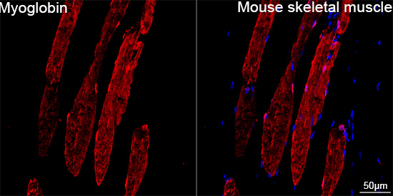 Myoglobin Antibody in Immunohistochemistry (Paraffin) (IHC (P))