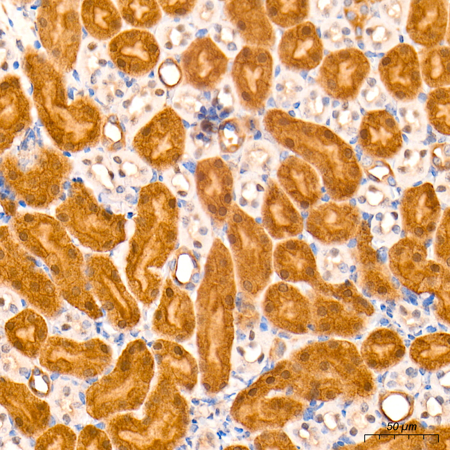 MKL1 Antibody in Immunohistochemistry (Paraffin) (IHC (P))
