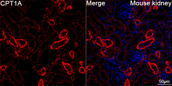 CPT1A Antibody in Immunohistochemistry (Paraffin) (IHC (P))