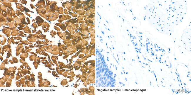 MYH7 Antibody in Immunohistochemistry (Paraffin) (IHC (P))