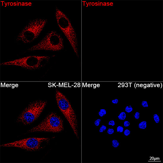 Tyrosinase Antibody in Immunocytochemistry (ICC/IF)