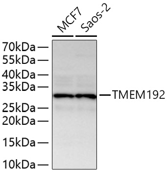 TMEM192 Antibody in Western Blot (WB)