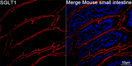 SGLT1 Antibody in Immunohistochemistry (Paraffin) (IHC (P))