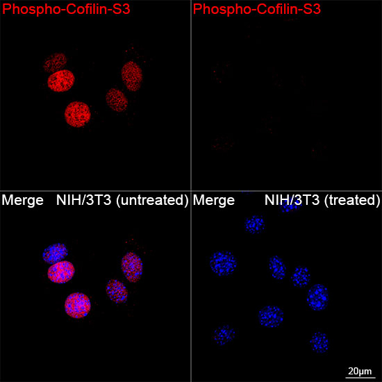 Phospho-Cofilin (Ser3) Antibody in Immunocytochemistry (ICC/IF)