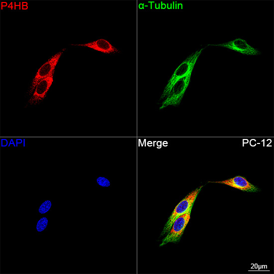 PDI Antibody in Immunocytochemistry (ICC/IF)
