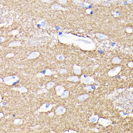 CD56 Antibody in Immunohistochemistry (Paraffin) (IHC (P))