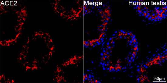 ACE2 Antibody in Immunohistochemistry (Paraffin) (IHC (P))