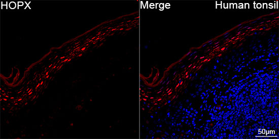 HOPX Antibody in Immunohistochemistry (Paraffin) (IHC (P))