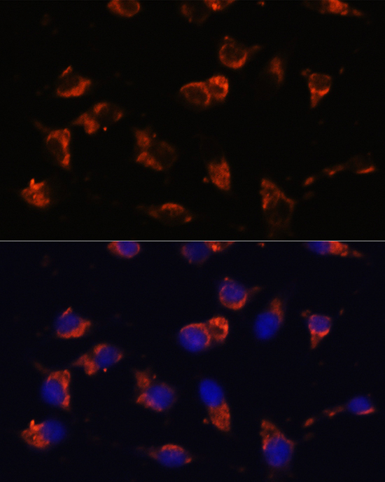 CA19-9 Antibody in Immunocytochemistry (ICC/IF)