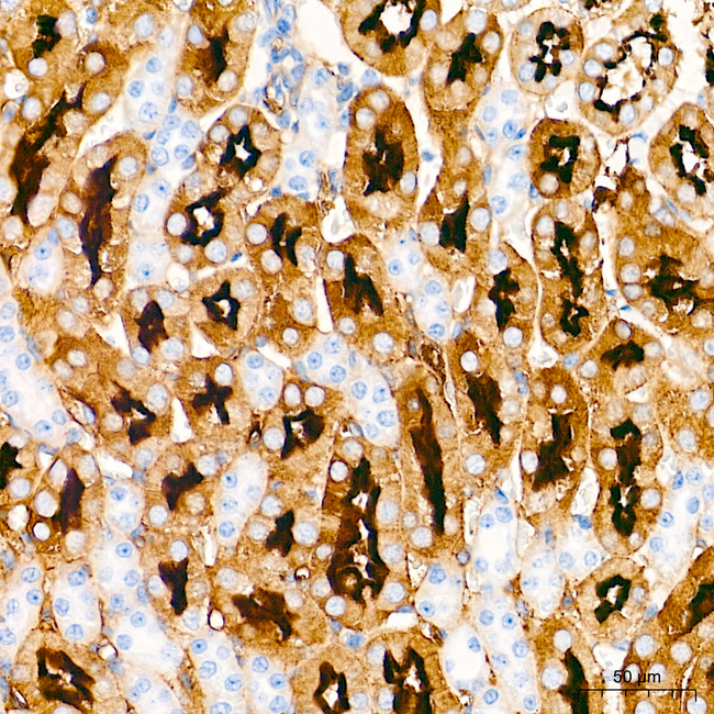Villin Antibody in Immunohistochemistry (Paraffin) (IHC (P))