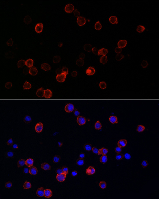 CD141 Antibody in Immunocytochemistry (ICC/IF)