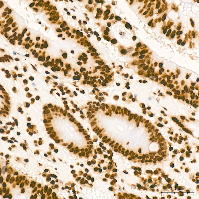 H3K79me1 Antibody in Immunohistochemistry (Paraffin) (IHC (P))
