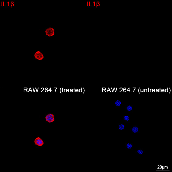 IL-1 beta Antibody in Immunocytochemistry (ICC/IF)
