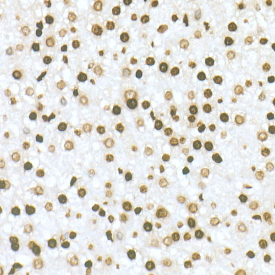 H3K36me2 Antibody in Immunohistochemistry (Paraffin) (IHC (P))