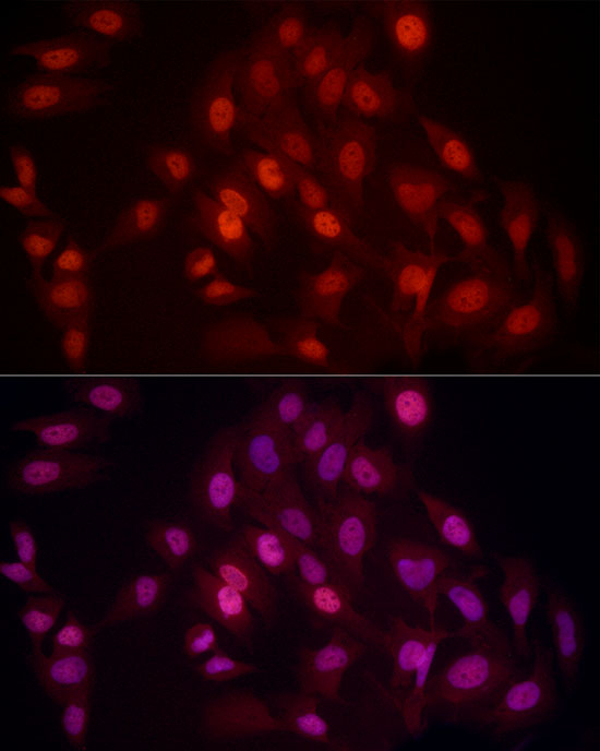 H4K20me2 Antibody in Immunocytochemistry (ICC/IF)