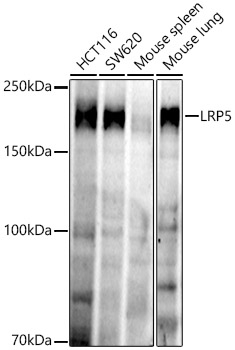 LRP5 Antibody in Western Blot (WB)