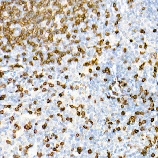 CD3 Antibody in Immunohistochemistry (Paraffin) (IHC (P))