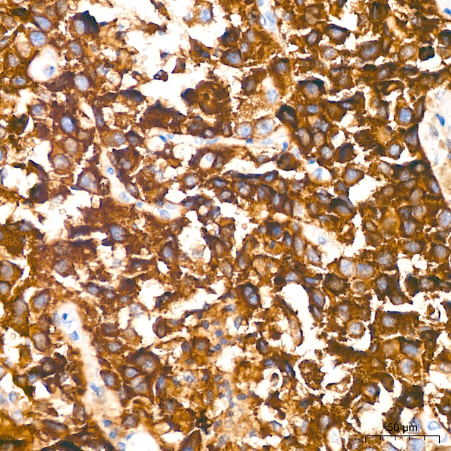 CD63 Antibody in Immunohistochemistry (Paraffin) (IHC (P))