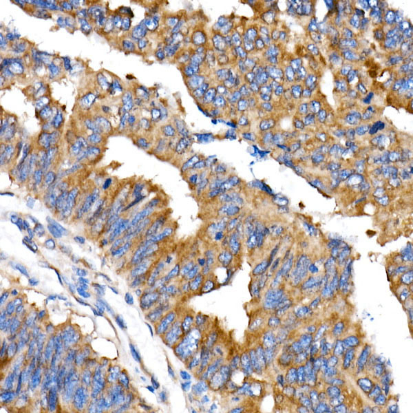 DAP5 Antibody in Immunohistochemistry (Paraffin) (IHC (P))