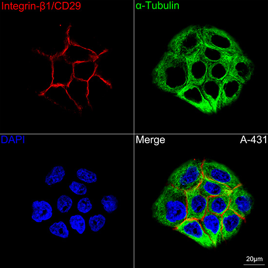 CD29 Antibody in Immunocytochemistry (ICC/IF)