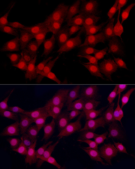 Estrogen Receptor alpha Antibody in Immunocytochemistry (ICC/IF)
