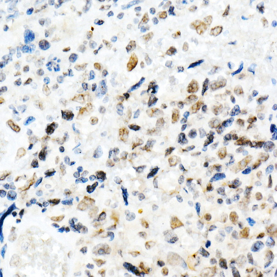 SMARCB1 Antibody in Immunohistochemistry (Paraffin) (IHC (P))