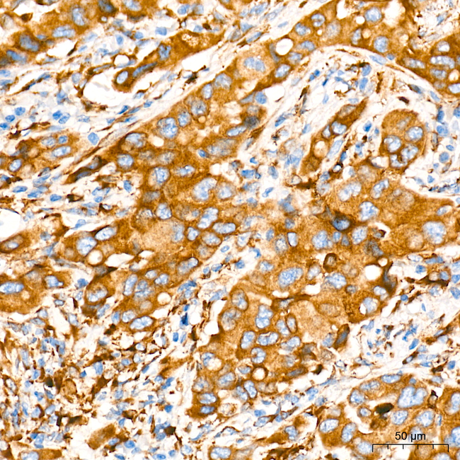 PLOD3 Antibody in Immunohistochemistry (Paraffin) (IHC (P))