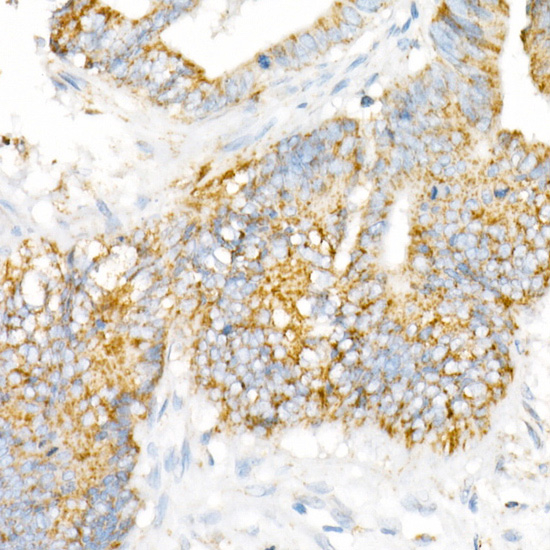 VDAC2 Antibody in Immunohistochemistry (Paraffin) (IHC (P))