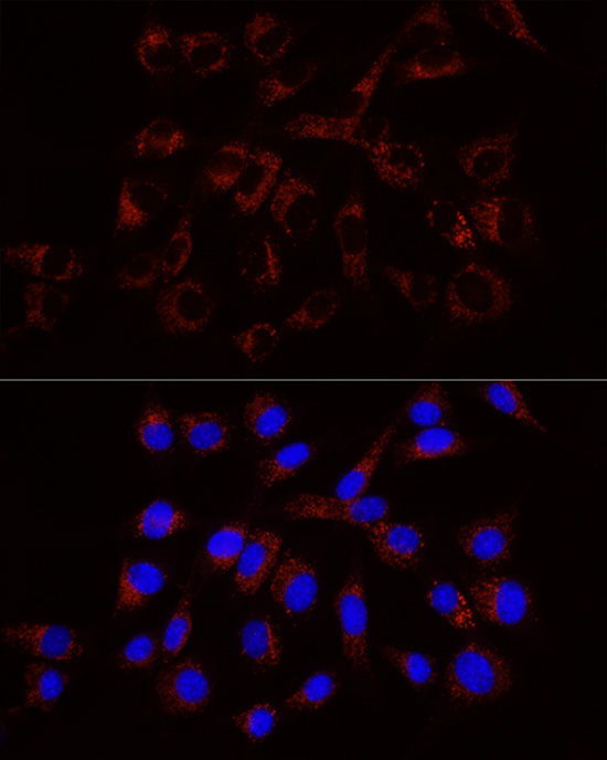 RAB7A Antibody in Immunocytochemistry (ICC/IF)