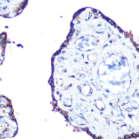 LC3A Antibody in Immunohistochemistry (Paraffin) (IHC (P))