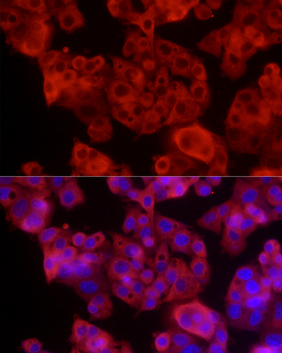ALDH1A1 Antibody in Immunocytochemistry (ICC/IF)