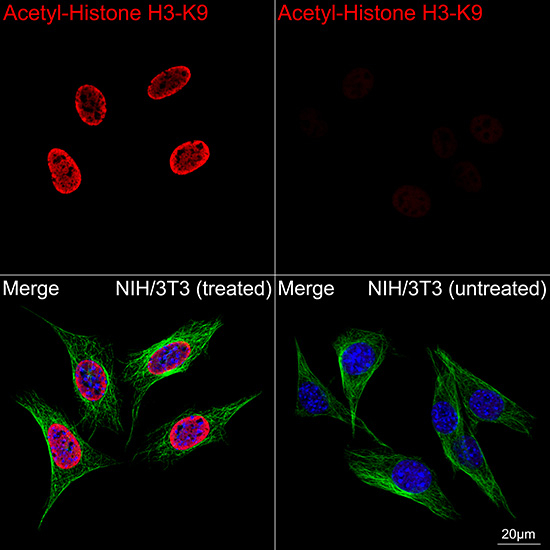 H3K9ac Antibody in Immunocytochemistry (ICC/IF)
