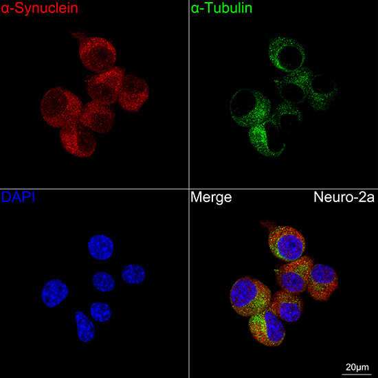 alpha Synuclein Antibody in Immunocytochemistry (ICC/IF)