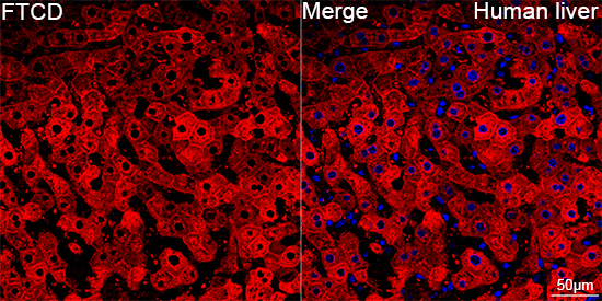 FTCD Antibody in Immunohistochemistry (Paraffin) (IHC (P))