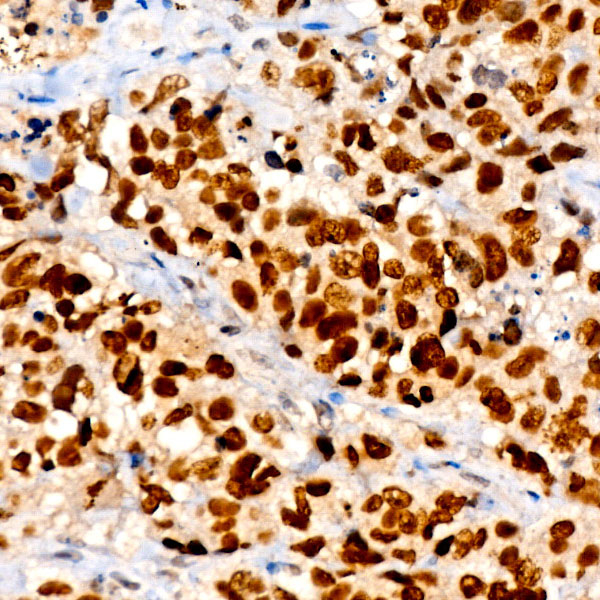 Nkx2.1 Antibody in Immunohistochemistry (Paraffin) (IHC (P))