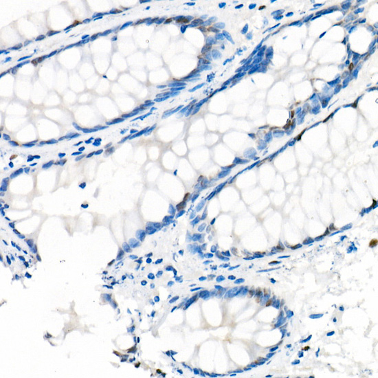 YAP1 Antibody in Immunohistochemistry (Paraffin) (IHC (P))