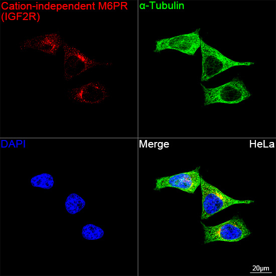 IGF2R Antibody in Immunocytochemistry (ICC/IF)