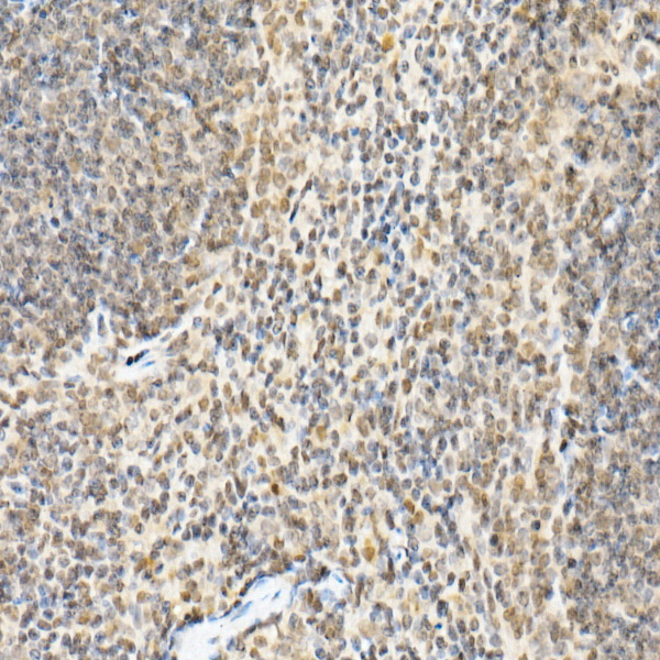 FADD Antibody in Immunohistochemistry (Paraffin) (IHC (P))